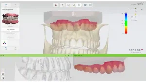 Import 3shape Scans Into Exocad